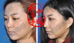 爆料小曼视频,独家爆料背后的真相与内幕